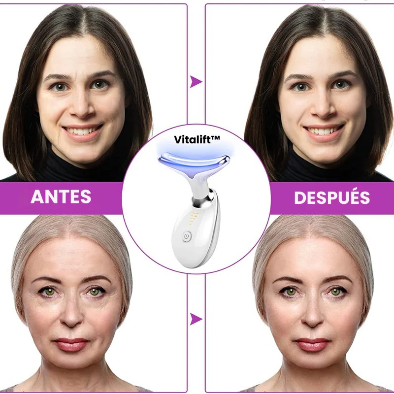 Miniatura 5 de Masajeador facial antipapada CON LUZ LED